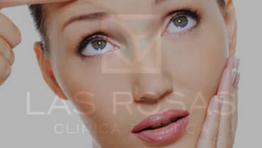 Lifting de Cejas