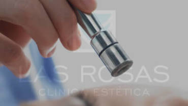 Microdermoabrasión con punta de diamante