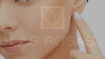 Otoplastía