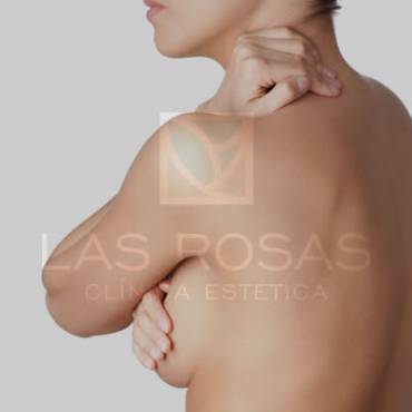 Reducción Mamaria