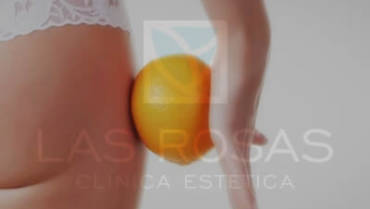 Tratamientos estéticos