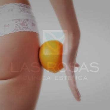 Tratamientos estéticos