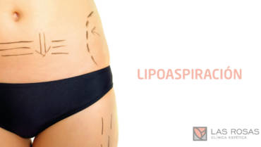 ALGUNOS MITOS SOBRE LAS CIRUGÍAS PLÁSTICAS