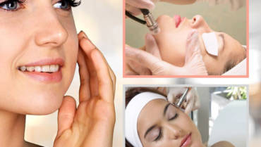 MICRODERMOABRASIÓN CRISTAL