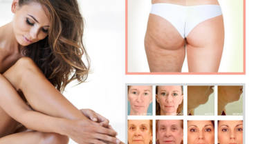 TRATAMIENTO CON ACCENT ULTRA – PIXEL