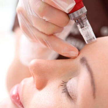 Dermapen Facial